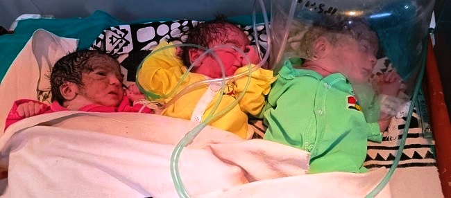 महिला ने ​दिया 03 जुड़वा बच्चों को जन्म