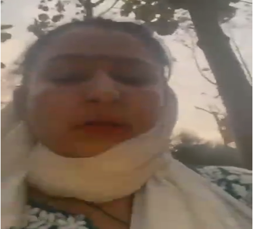 joyati aadhakari हल्द्वानी : काठगोदाम के जंगल में सकुशल मिलीं ब्लॉगर ज्योति अधिकारी